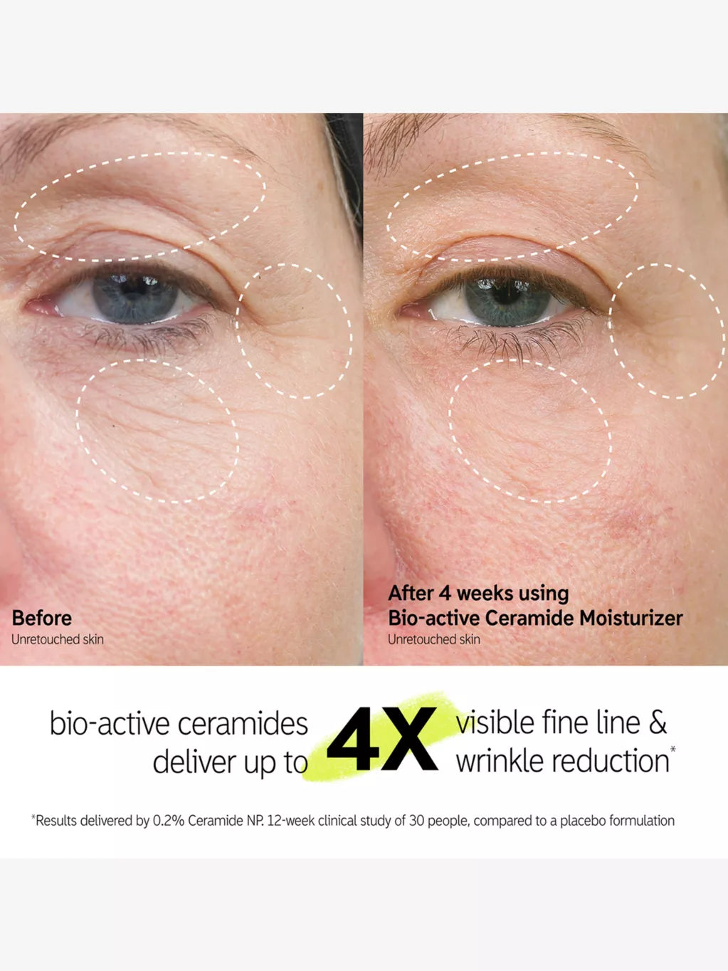 Bio-Active Ceramide Repairing and Plumping moisturiser 50ml