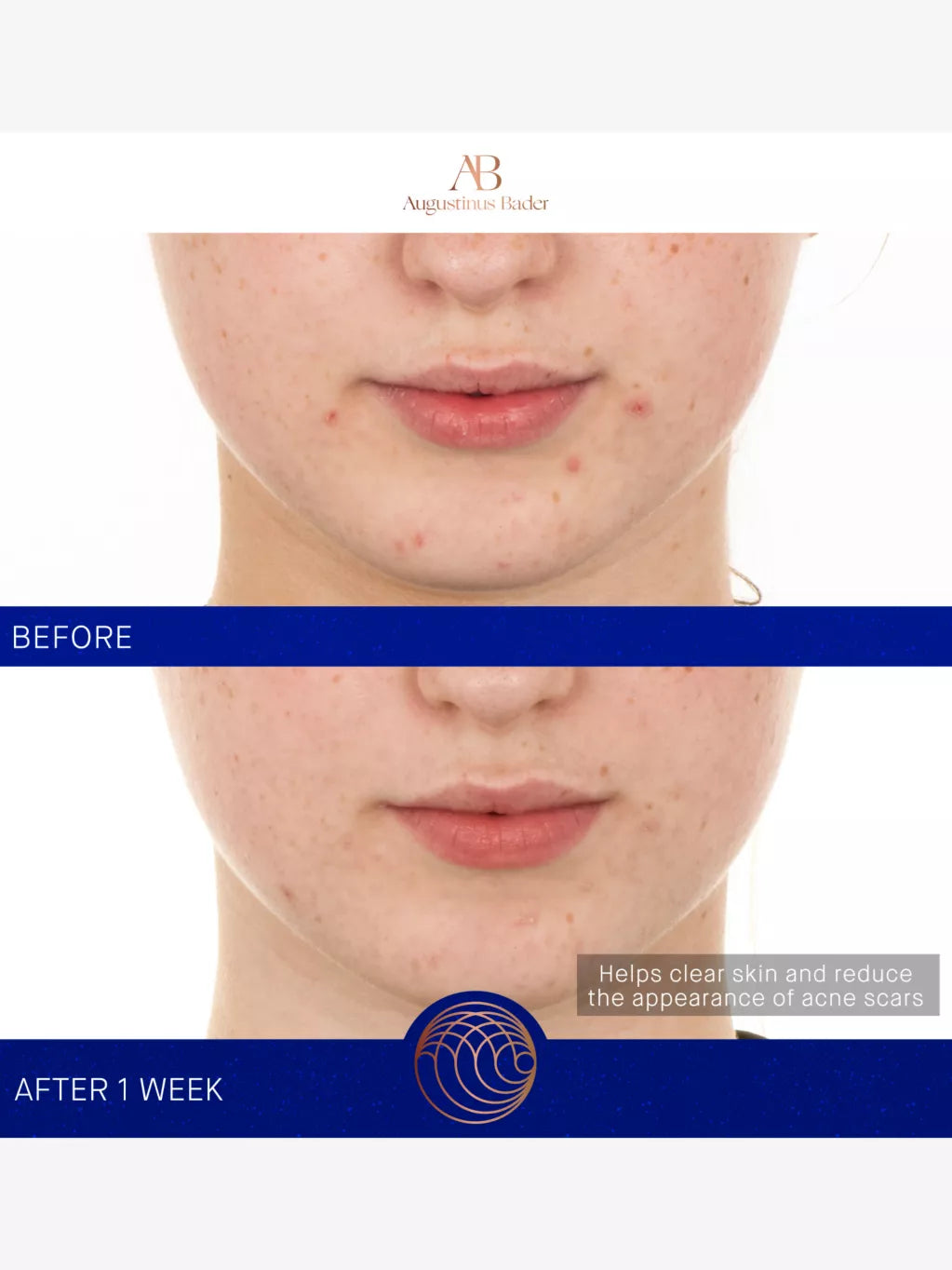 The Retinol Serum 30ml